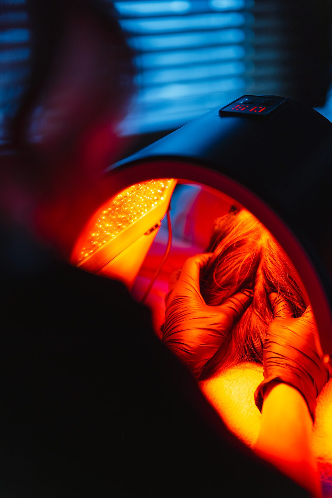 PRP — Hair Restoration & Face