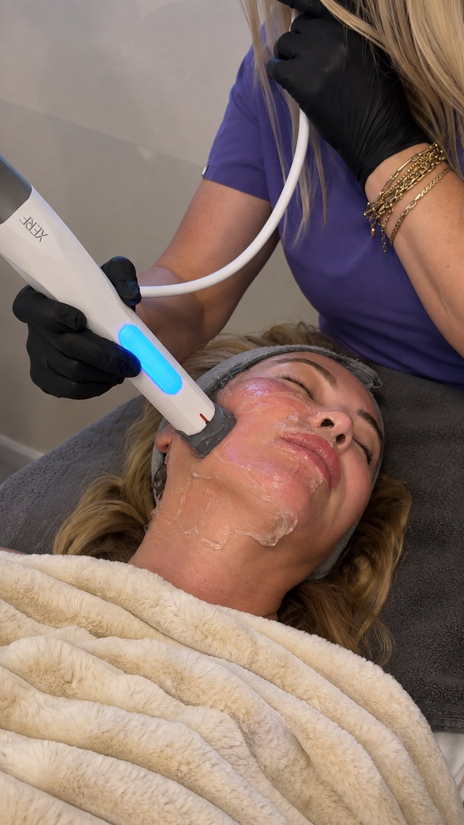 XERF Skin Tightening & Lifting